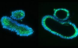 基于类器官的课题基金文章思路整理设计