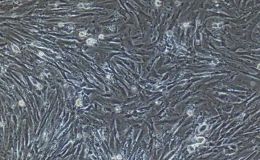 成纤维原代细胞提取