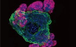 类器官基因敲除（CRISPR/Cas9）套餐