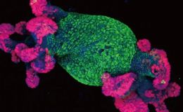 类器官基因敲低（shRNA慢病毒）套餐