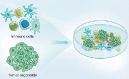 类器官-免疫细胞共培养模型
