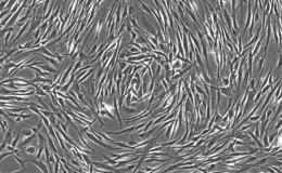 类器官-肿瘤原代癌相关成纤维细胞（CAF）共培养模型