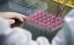 血管化肿瘤类器官-免疫细胞共培养模型