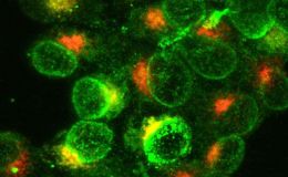 免疫杀伤效率定量-实时活细胞成像