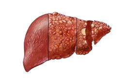 酒精性肝损伤(ALD)肝类器官模型构建
