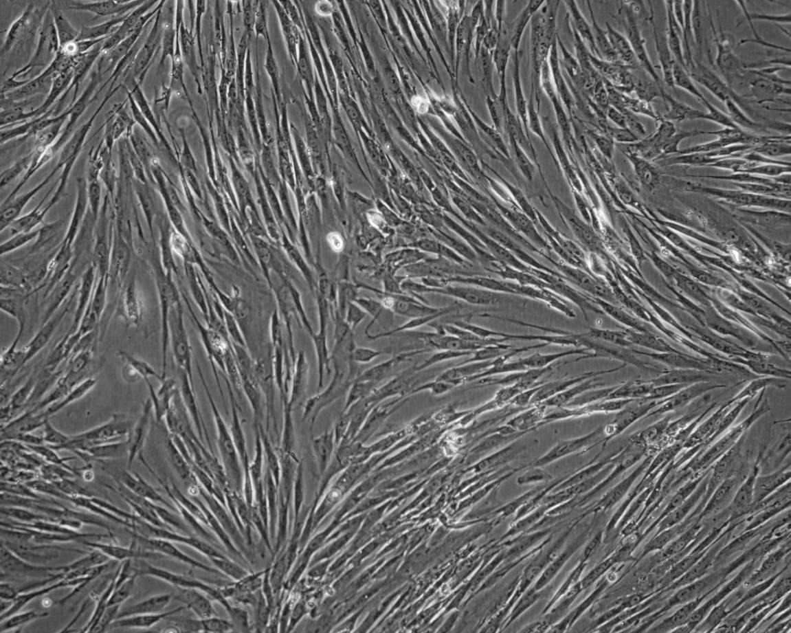 平滑肌细胞模式图图片